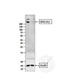 BRCA 2